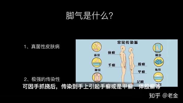 为什么有脚气的脚臭一点