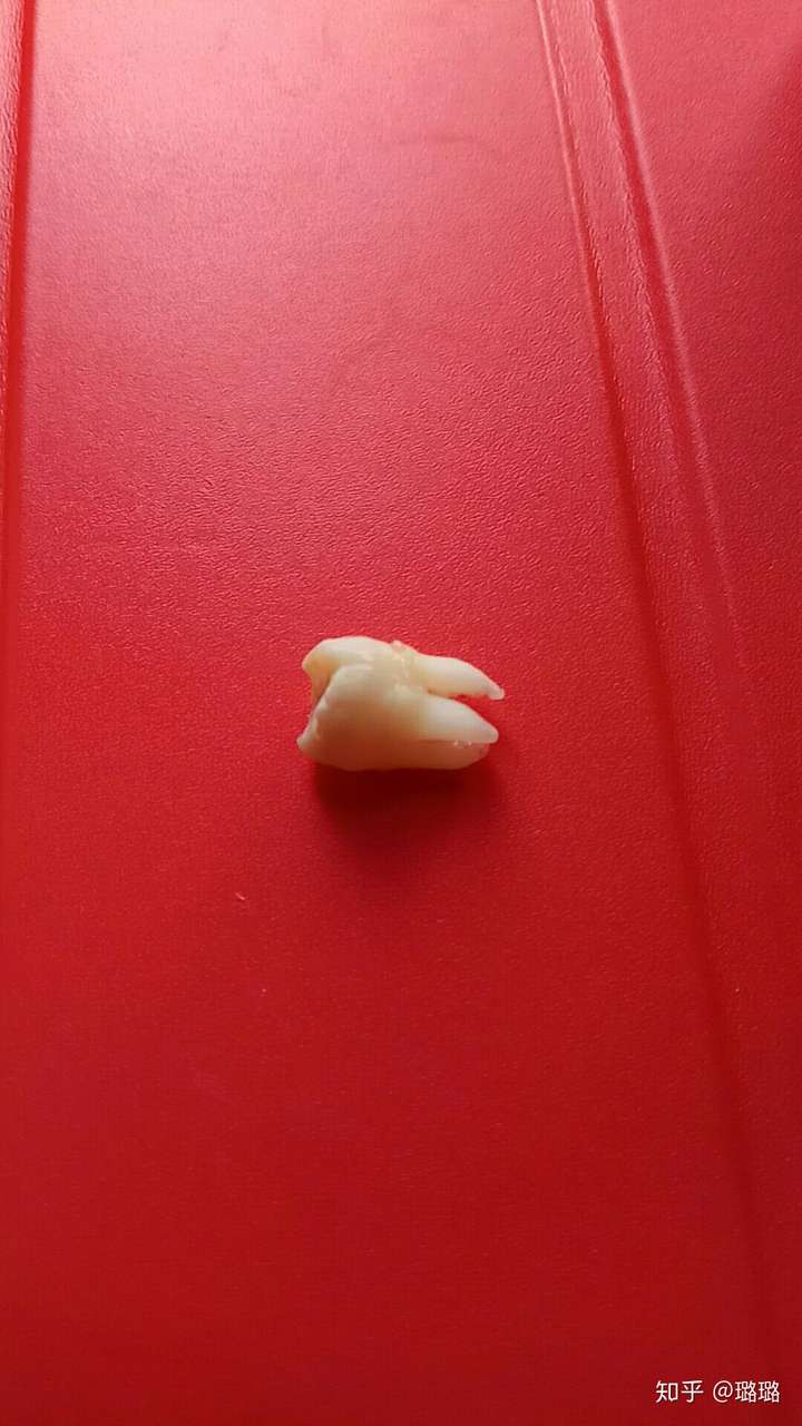 右下智齿拔完了一直流血.怎么办? ?