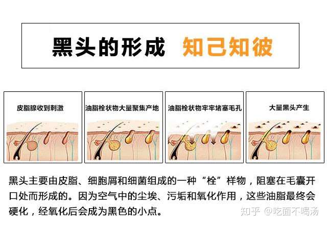 客观分析一下为什么杨超越不长黑头?