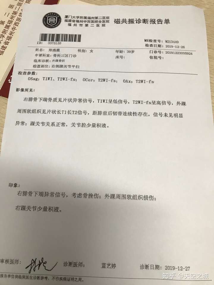 右距骨挫伤 右踝关节少量积液如何治疗?