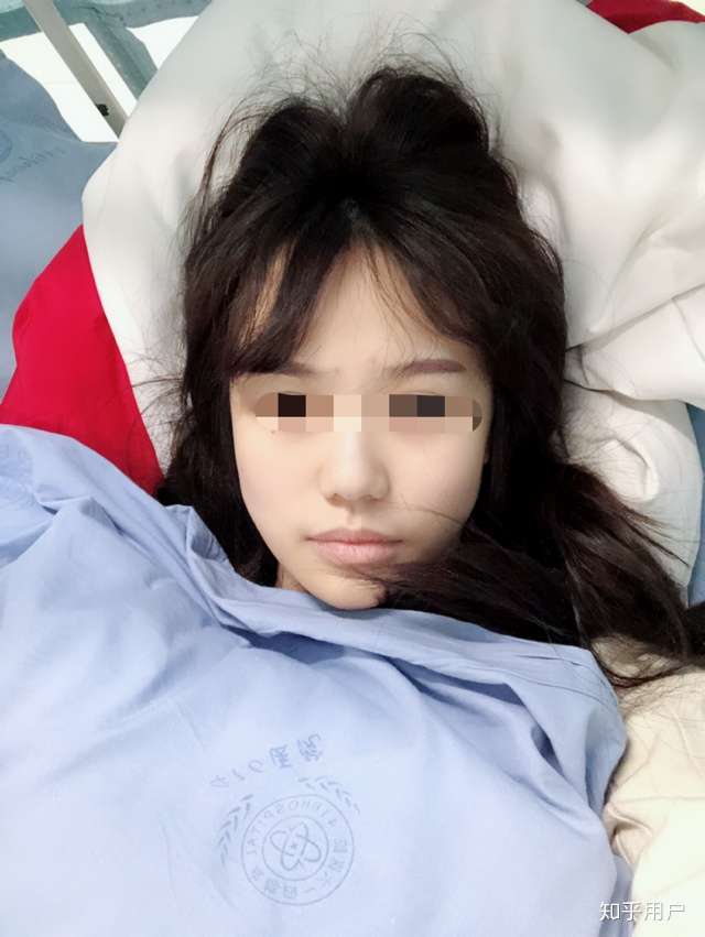 经历痔疮手术是种怎样的体验?