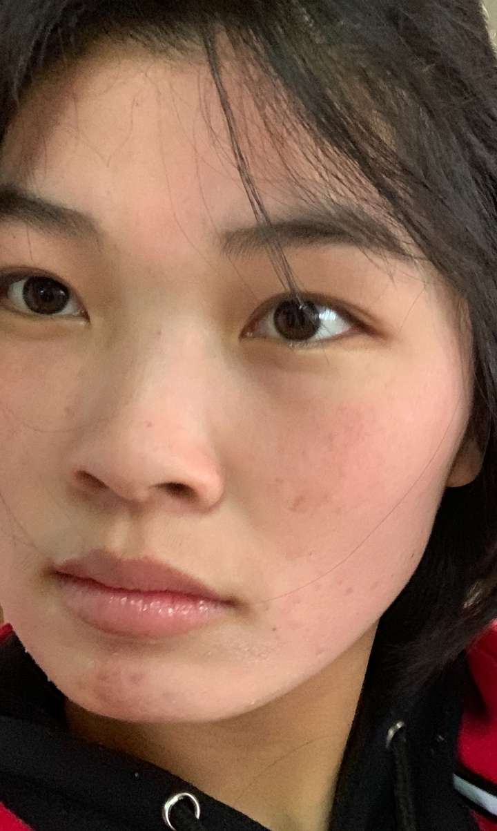 各位觉得长雀斑的女孩子怎么样呀?