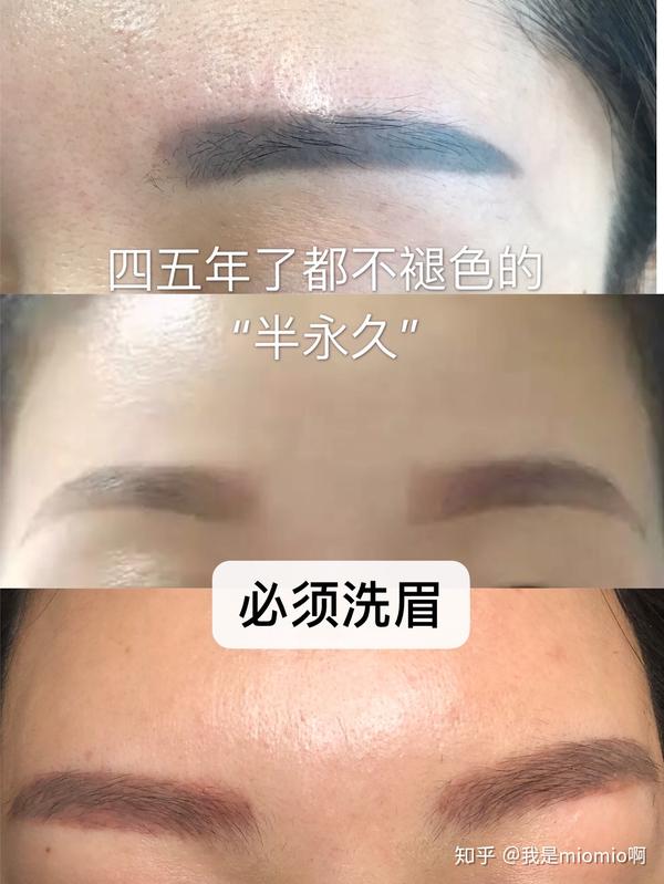 让色料和血液进一步结合后期眉毛变蓝色,或感染发炎更影响恢复,一切