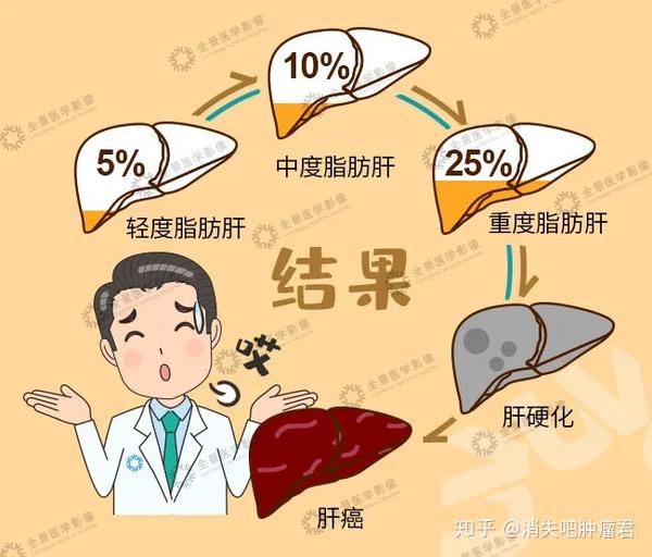 拒绝肝扰脂肪肝不是小问题