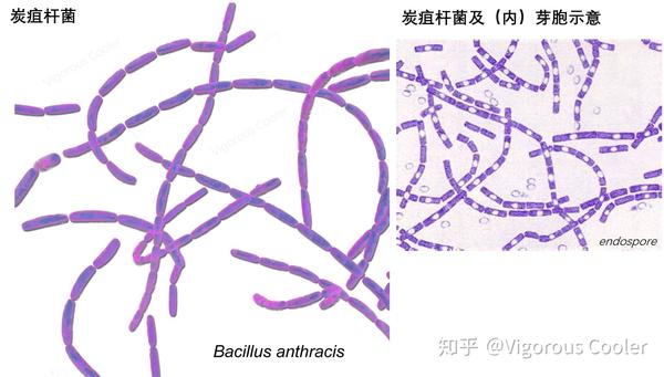 炭疽杆菌何德何能,生命力这么顽强?