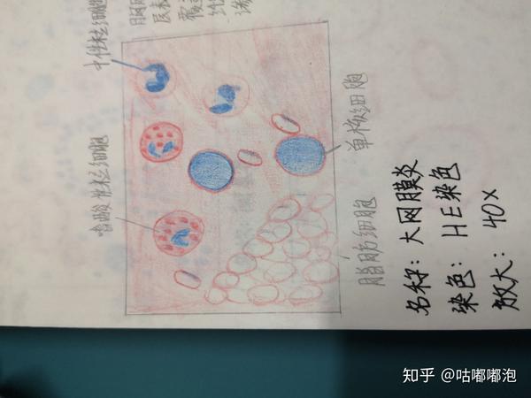 10.纤维素性胸膜炎