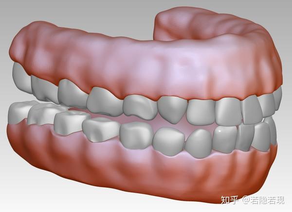 牙齿牙龈3d图下载,3d口腔模型下载,逼真高清牙龈模型图片素材