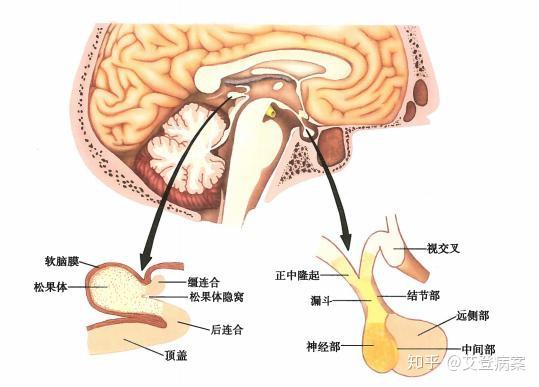 大腺瘤(直径>10mm)和巨大腺瘤(直径>40mm);腺垂体的远侧部与结节部合