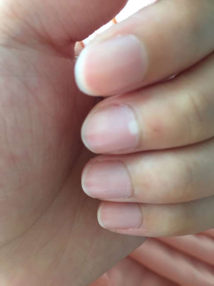 手指甲月芽图片