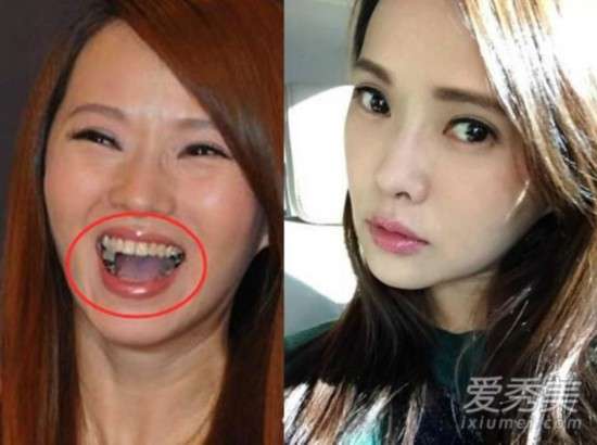 的口腔问题困扰——97%的成人患有牙结石,88%有龋齿,85%有牙龈问题,再