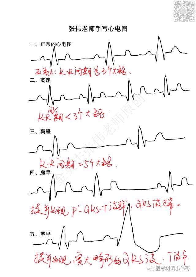 一文教你如何做一张手写的心电图