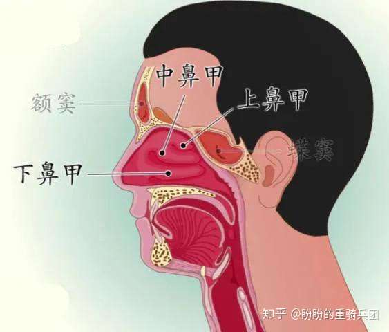 鼻息肉是什么得了鼻息肉一定要手术吗