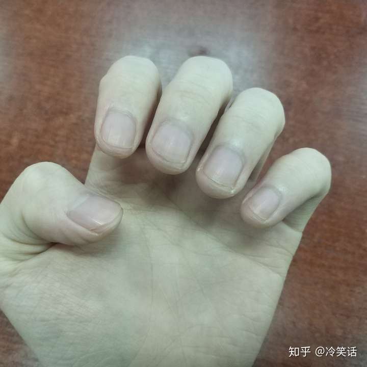 打算学一下吉他,就想问:指甲要剪多短?