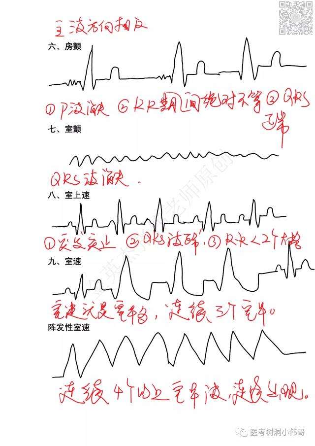 一文教你如何做一张手写的心电图