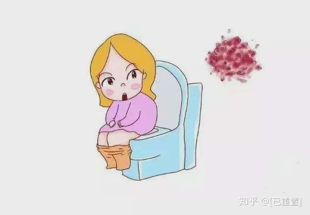 产后恶露掉色了!怎么回事?