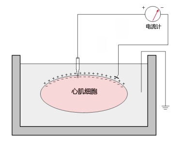 心电图词典003