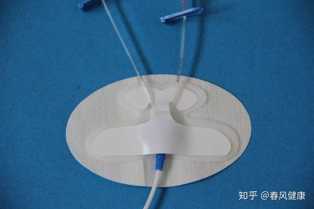 PICC日常护理——如何保护好这条独特的“生命线”(一) - 知乎
