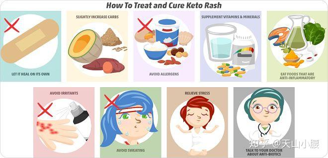 Keto Rash Leg 生酮期间的“酮疹”,怎么破? - 知乎