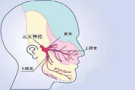 首大李健东什么是hunt综合征