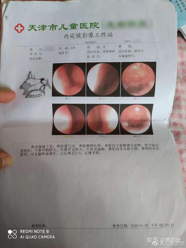 检测没说孩子海鲜过敏啊为什么吃了身上还是起疹子