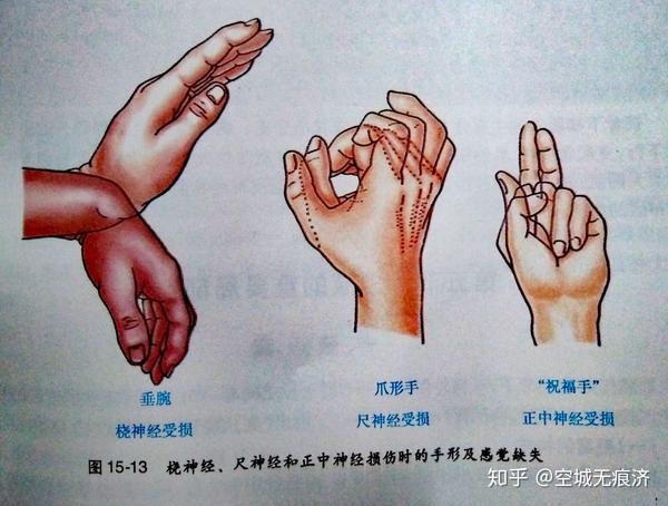 解剖学相关习题19 - 知乎