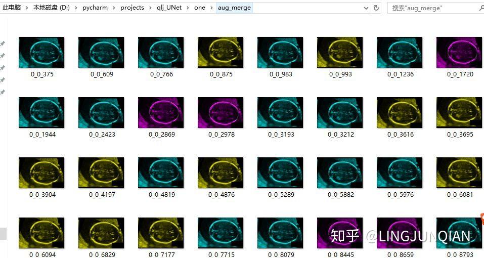  data augmentation keras imagedatagenerator 