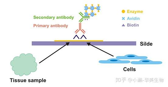 免疫组化（IHC）与病理诊断 - 知乎