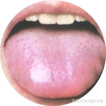 为什么老中医都要看你的舌苔,史上最全舌苔看病大全 - 知乎