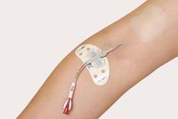 化疗后皮肤副反应明显出现红斑破溃该怎么办居家如何护理