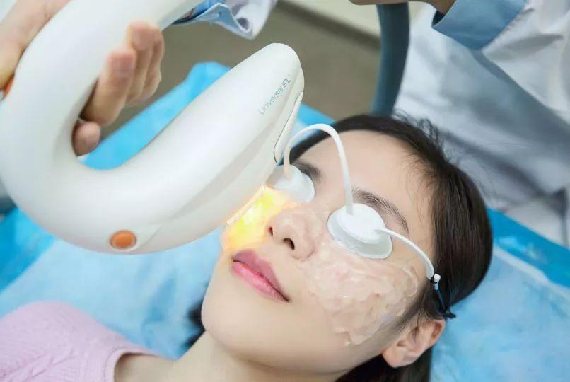 迷莎 干眼症咨询师 强脉冲光(ipl)是一种脉冲式的,高强度的宽谱光