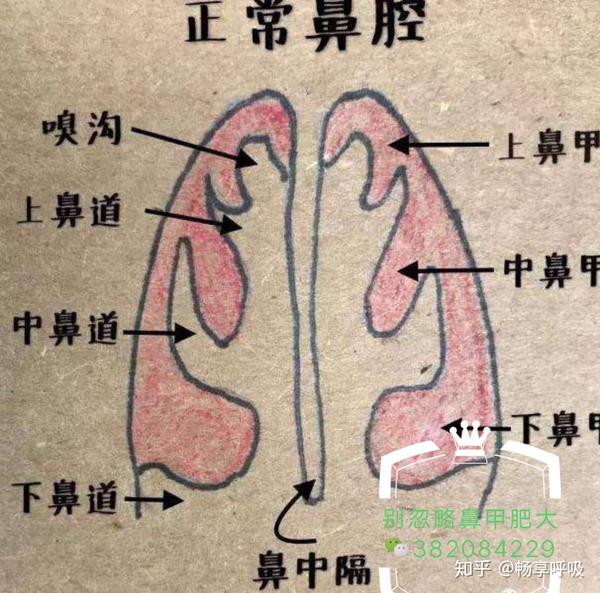 别只顾着腺样体而忽略了鼻甲肥大