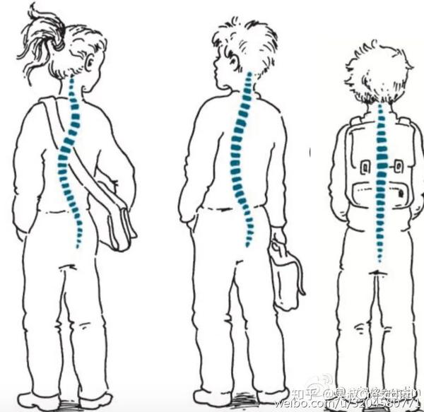 预防青少年脊柱侧弯从正确背书包开始