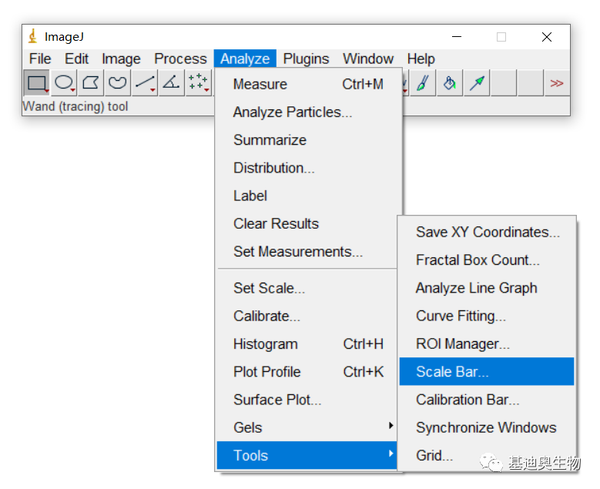 生信工具教程如何用imagej自由调整显微照片的标尺