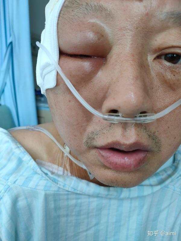 传递爱心老爸请不要被胃癌晚期打倒这个家还需要你
