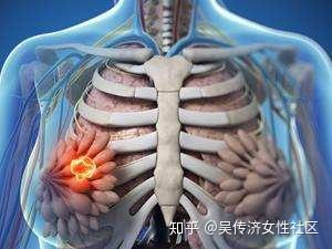 女性如何避免乳腺癌乳腺癌早期身體信號反應