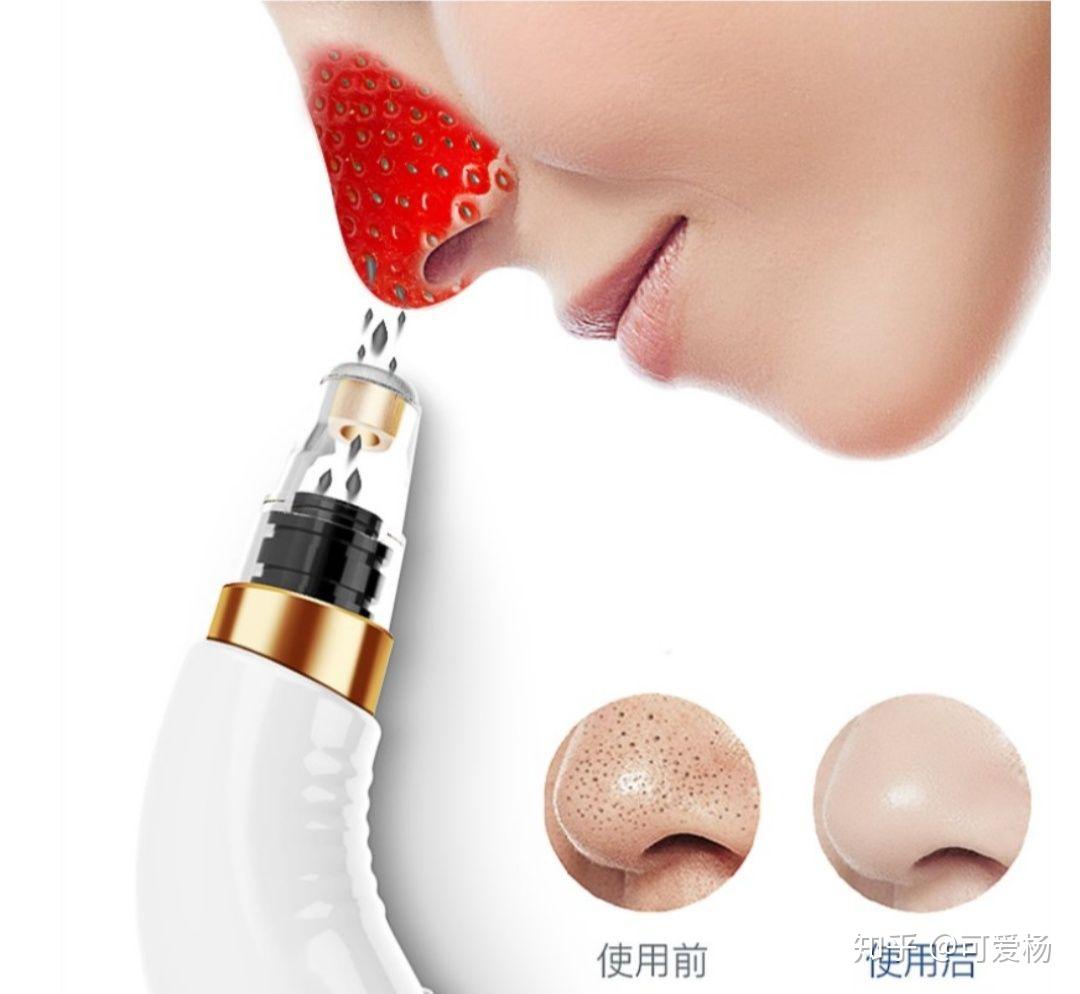 电动去黑头仪器有用吗？告别黑头就靠他了