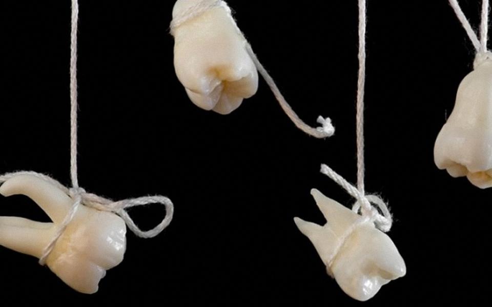 梦境解析，梦见牙齿掉落——是祸是福？一场关于心理与健康的深度探索