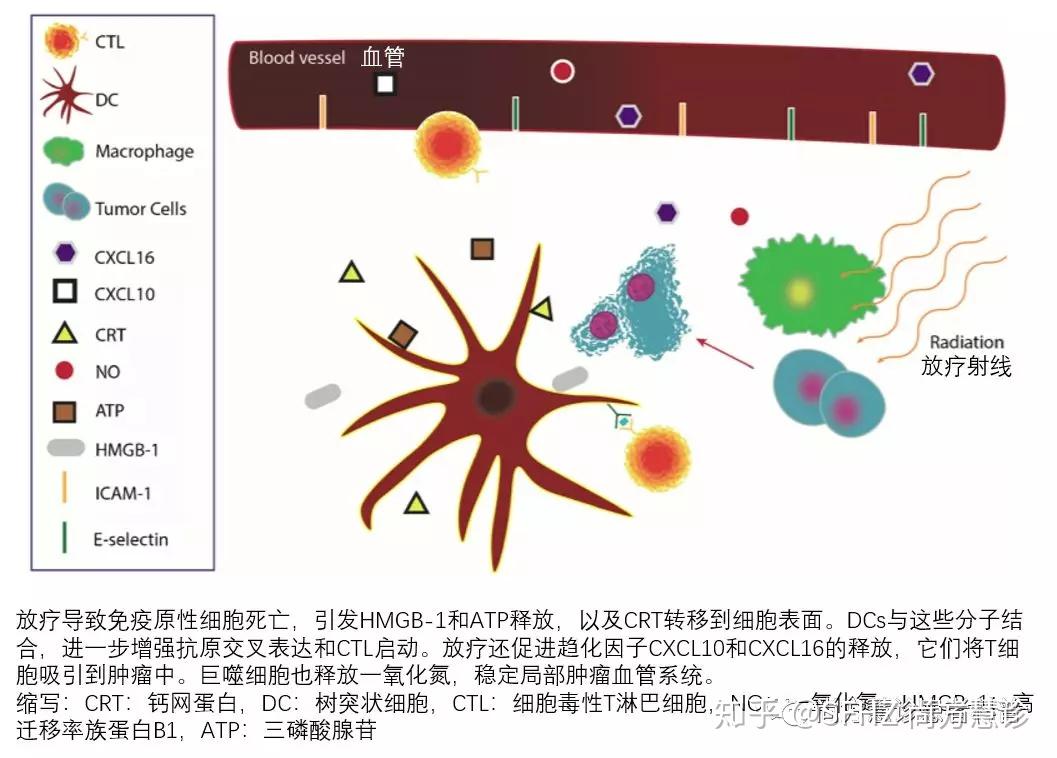 晚期/转移性癌症患者:放疗联合免疫治疗的远隔效应可使生存翻番 - 知乎