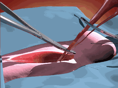 宠物去势手术操作详解